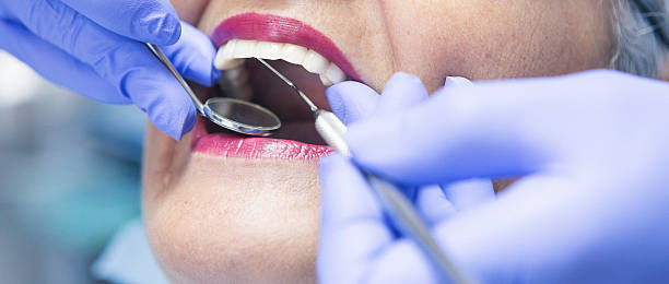 Best Emergency Dentist for Knocked-Out Tooth in Astatula, FL